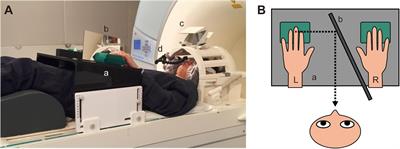 Cortical Regions Encoding Hardness Perception Modulated by Visual Information Identified by Functional Magnetic Resonance Imaging With Multivoxel Pattern Analysis